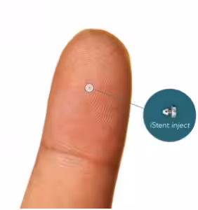 Minimal Invasive Glaucoma Surgery